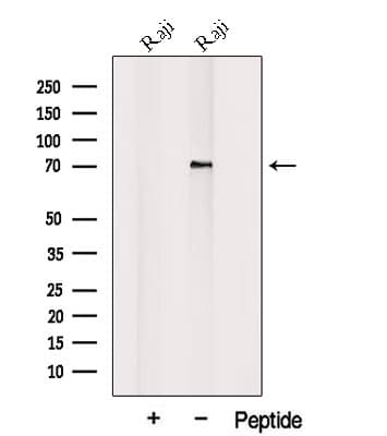 PLAGL2 Antibody