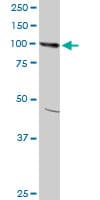 Monoclonal Mouse anti-Human AMPD2 Antibody (clone 6A8, WB)