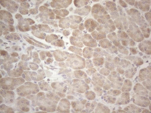 Monoclonal Mouse anti-Human MAGEB3 Antibody (clone OTI5H8, IHC, WB)