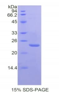 Mouse PTGS1 / COX-1 Protein (Recombinant His)