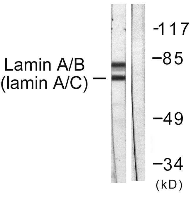 LMNA / Lamin A+C Antibody (p392)