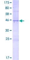 Human VIT Protein (Recombinant GST)