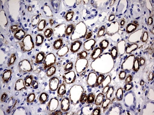 MCAM / CD146 Antibody (clone OTI5C4)