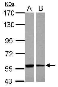 IHC-plus™ Polyclonal Rabbit anti-Human PHGDH Antibody (Internal, IHC, WB)