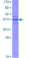 Human CD302 Protein (Recombinant GST)