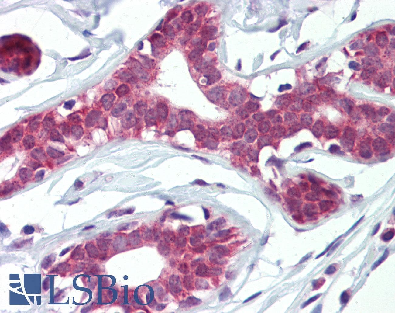 IHC-plus™ ELF4 / MEF Antibody (aa211-237)