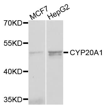 CYP-M / CYP20A1 Antibody