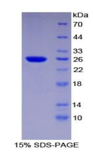 Mouse TNPO1 / Transportin 1 Protein (Recombinant His)