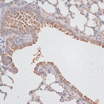 TWIK1 / KCNK1 Antibody