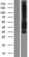 Human CCND3 / Cyclin D3 Protein (Over-Expression Lysate Myc-DDK (Flag))