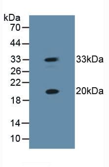 HSPB2 / HSP27 Antibody (aa12-182, PE)