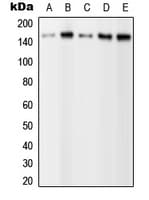 PLCG2 / PLC Gamma 2 Antibody (phospho-Tyr1217)