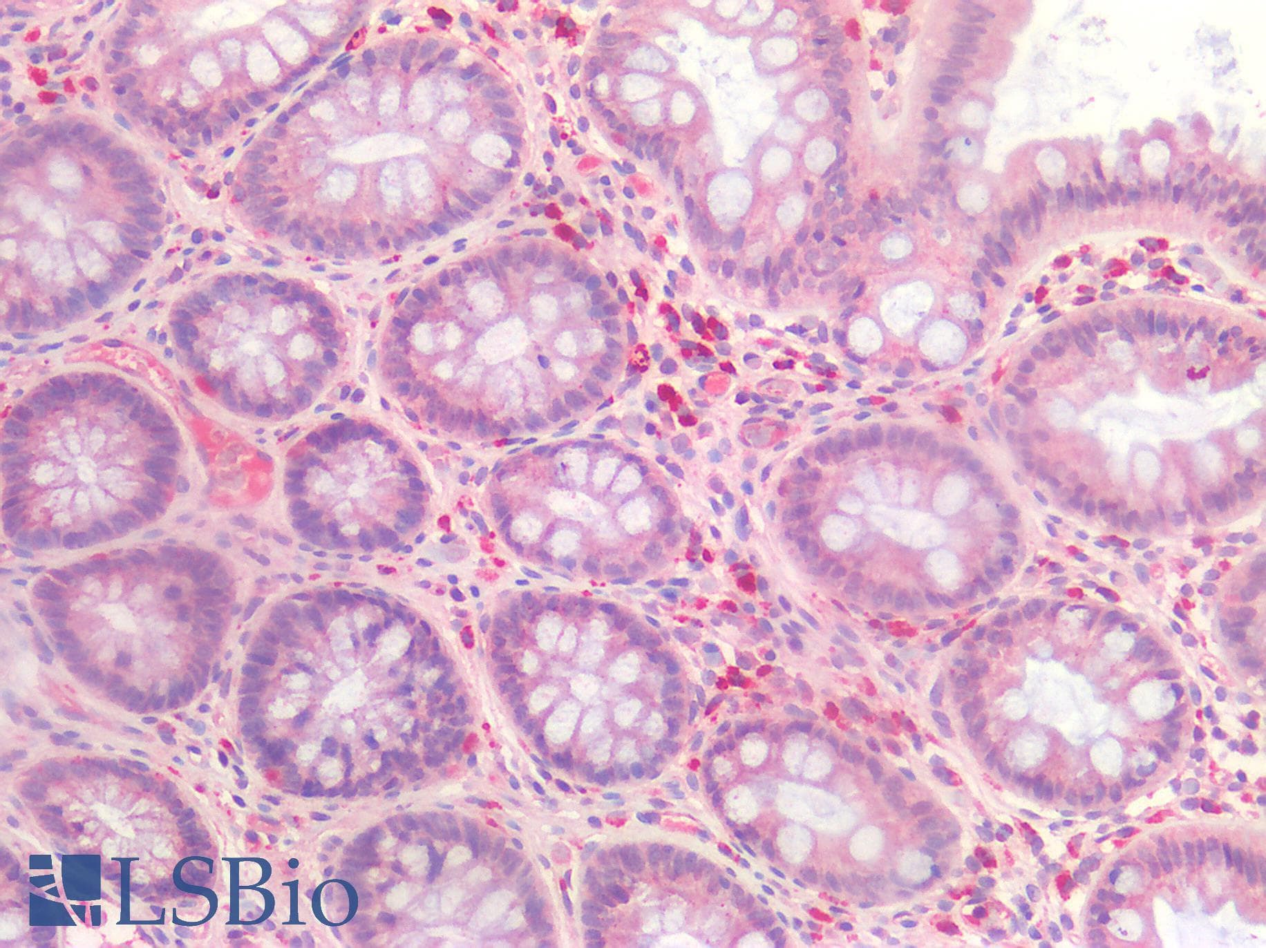 IHC-plus™ CASP3 / Caspase 3 Antibody