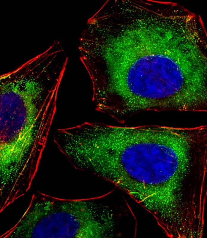 p56lck / LCK Antibody (clone 1526CT823.75.16)