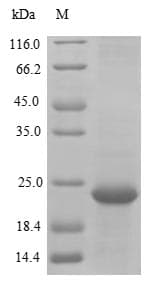Orangutan TMEM168 Protein (Recombinant 10His, N-terminus + Myc, C-terminus)
