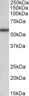 PathPlus™ TGFBR1 / ALK5 Antibody (aa50-63)