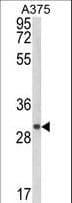 CTHRC1 Antibody (aa19-46)
