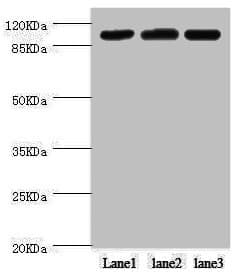 PITRM1 / MP1 Antibody