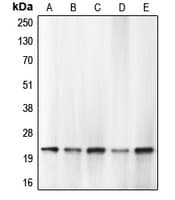 CASP1 / Caspase 1 Antibody (Internal)