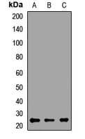 D52 / TPD52 Antibody