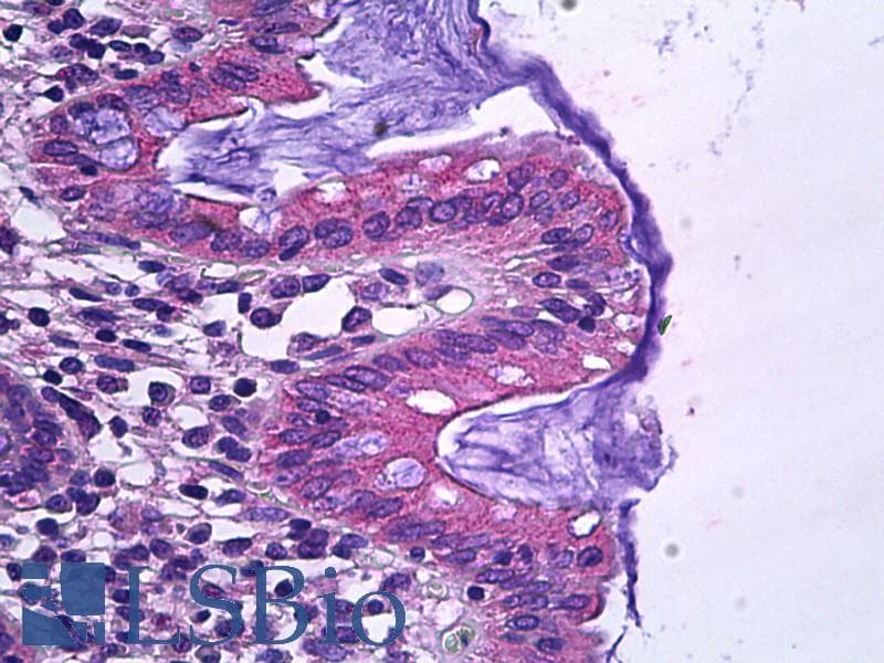 IHC-plus™ Polyclonal Goat anti-Human SLC12A2 / NKCC1 Antibody (aa769-783, IHC, IF)