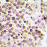 Polyclonal Rabbit anti-Human MKI67 / Ki67 Antibody (IHC, IF, WB)
