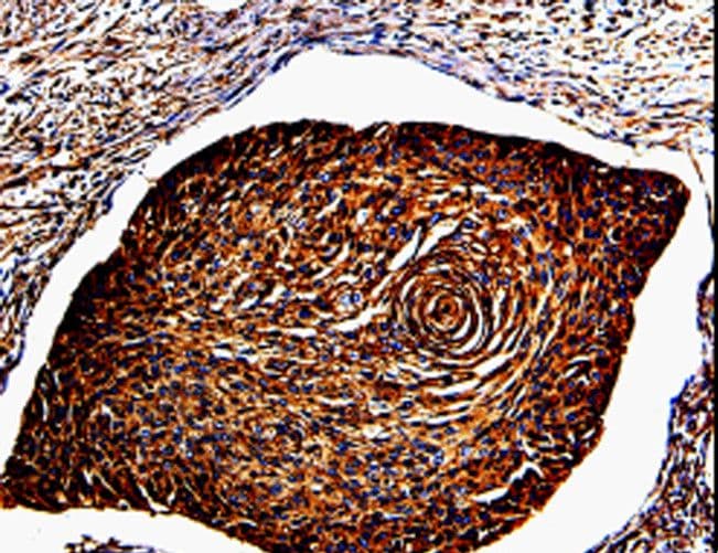 ANXA7 / Annexin VII / SNX Antibody