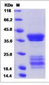 Human IL17A+IL17F Protein (Recombinant His,C-terminus)