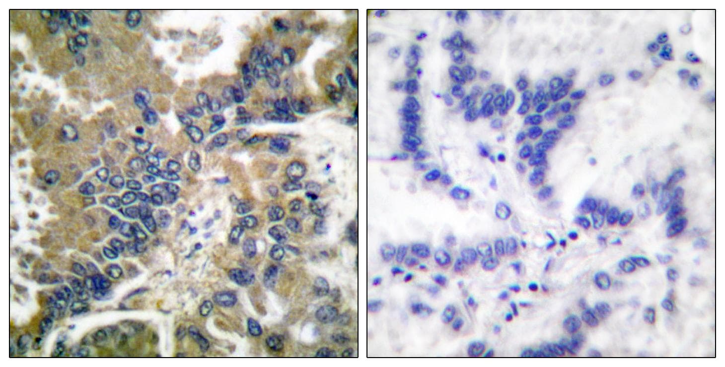 CASP1 / Caspase 1 Antibody (Cleaved-Asp210)