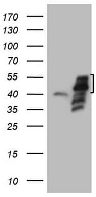 DJ858B16.2 / PISD Antibody (aa80-340, clone OTI2H1)