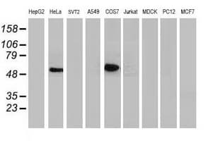 TP53 / p53 Antibody (clone OTI3A6)