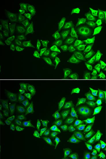 CREB3 / LZIP Antibody
