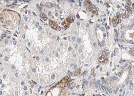Polyclonal Rabbit anti-Human NNT Antibody (IHC, IF, WB)