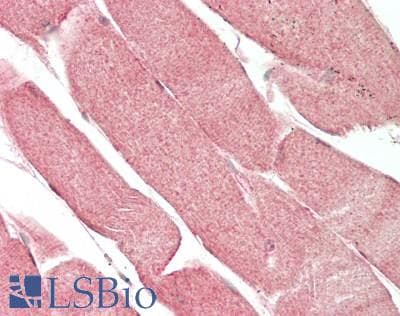 IHC-plus™ PPP1R16A Antibody (aa83-464)