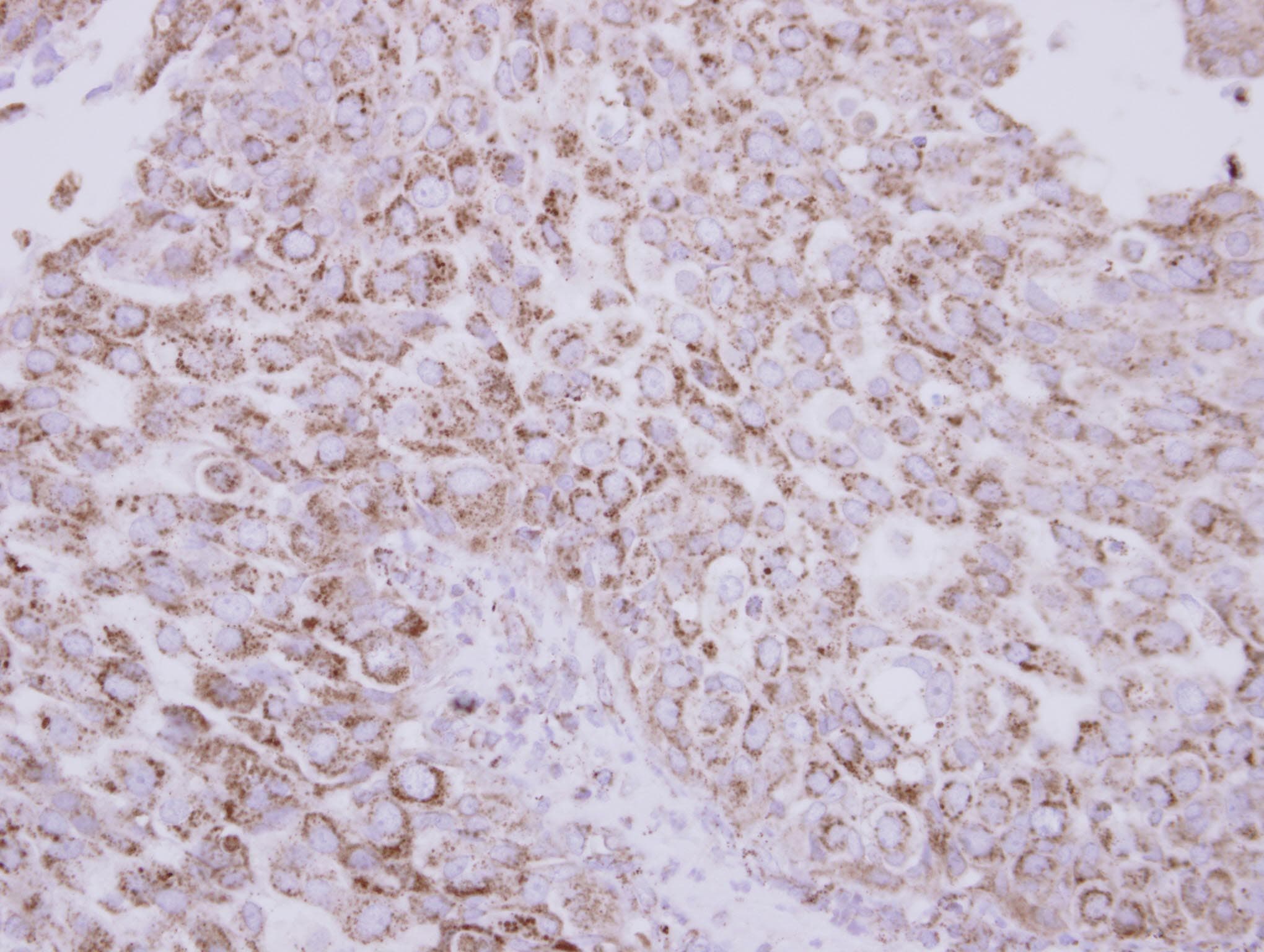 PROC / Protein C Antibody