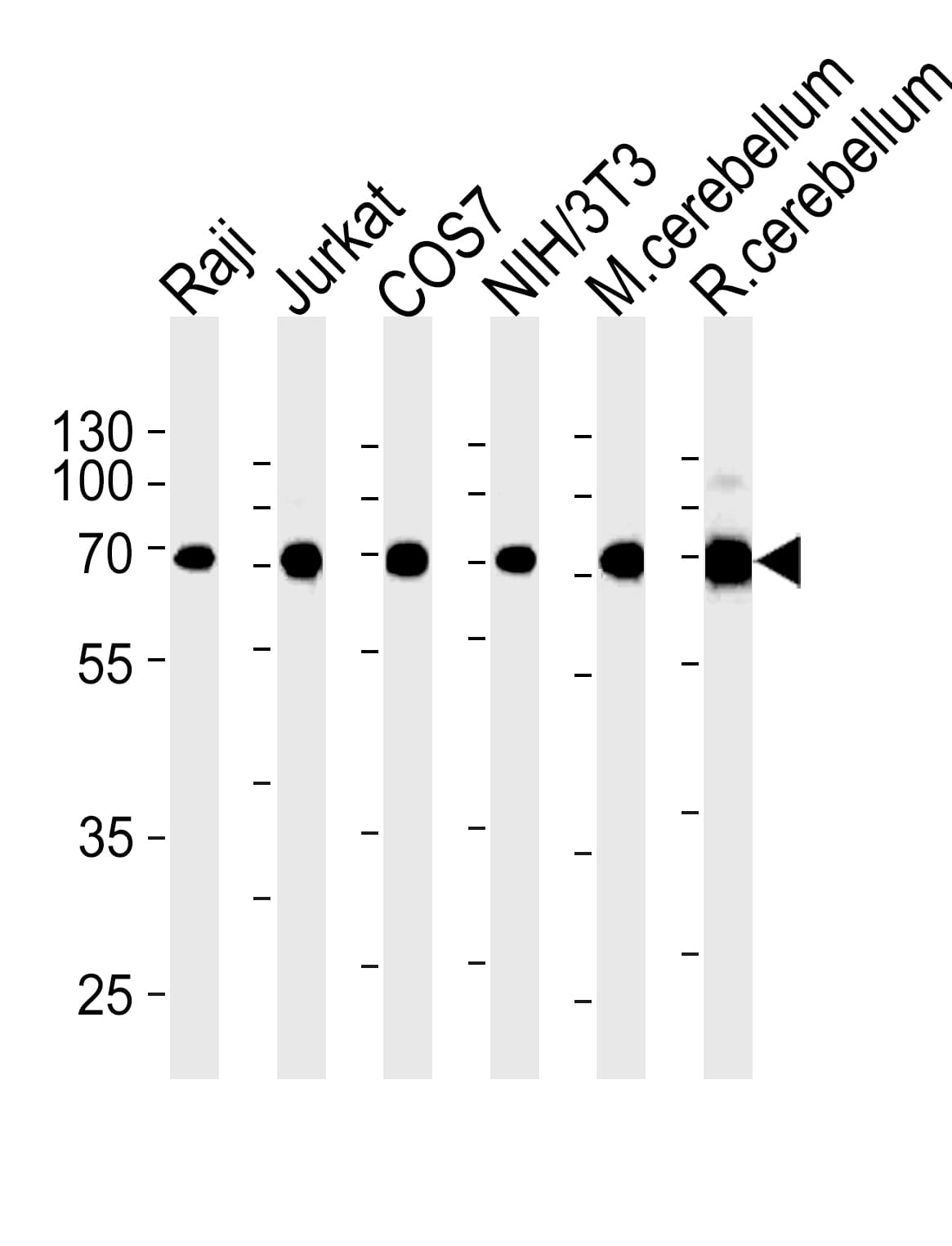 Monoclonal Mouse anti-Human ACHE / Acetylcholinesterase Antibody (clone 684CT8.3.4, aa587-611, WB)