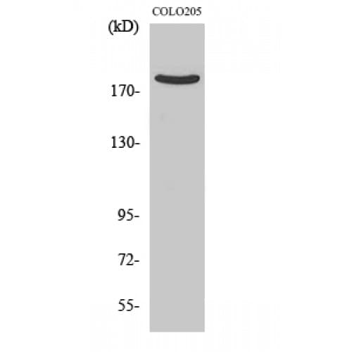 ARHGEF11 Antibody (170-250 aa, N-terminal)