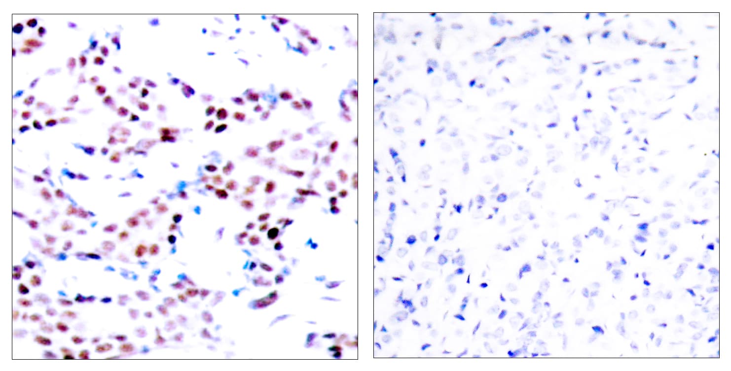 Polyclonal Rabbit anti-Human JUN / c-Jun Antibody (phospho-Thr91, IHC, WB)