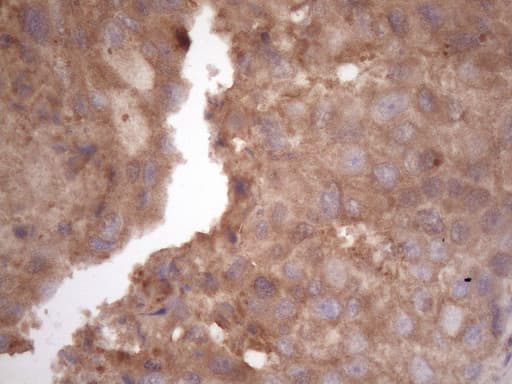 Monoclonal Mouse anti-Human HAVCR2 / TIM-3 Antibody (clone OTI2E2, aa22-202, IHC)