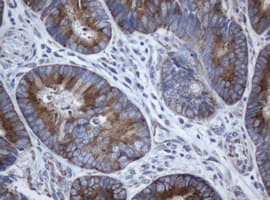 PAI-RBP1 / SERBP1 Antibody (aa1-262, clone OTI4F8, Carrier-free)