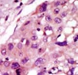 IRAK2 / IRAK-2 Antibody (aa549-581)