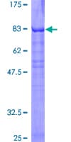 Human PKNOX1 / PREP1 Protein (Recombinant GST)