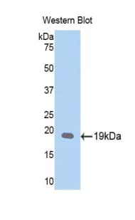 LOXL1 Antibody (aa367-514)