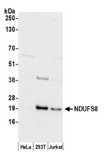 Polyclonal Rabbit anti-Human NDUFS8 Antibody (aa25-75, WB)
