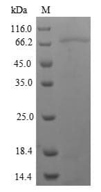 Human NRG3 Protein (Recombinant 6His-SUMO, N-terminus)