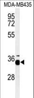 Polyclonal Rabbit anti-Human Prohibitin 2 / PHB2 Antibody (Tyr248, IHC, WB)