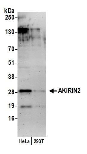 Polyclonal Rabbit anti-Human AKIRIN2 Antibody (aa50-100, WB)