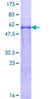 Human MDH / MDH2 Protein (Recombinant GST)