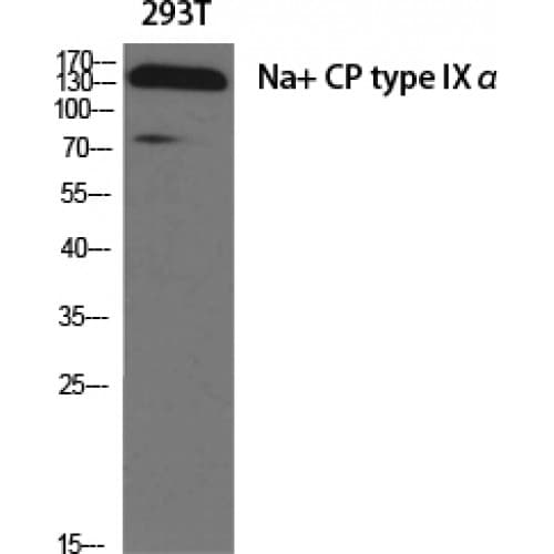 SCN9A / Nav1.7 Antibody (620-700 aa, Internal)