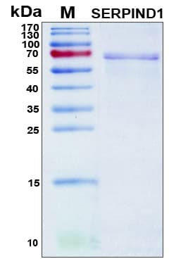 Human SERPIND1 / Heparin Cofactor 2 Protein (Recombinant 6His, N-terminus)